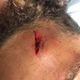 Image for article titled College Student Says He Was Attacked by Cops for Skateboarding Because ... Someone Could Get Hurt, You Know